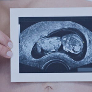 intrebari pentru prima consultatie prenatala