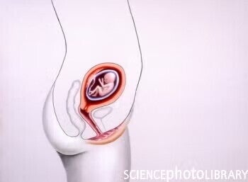 fat in saptamana 17 de sarcina